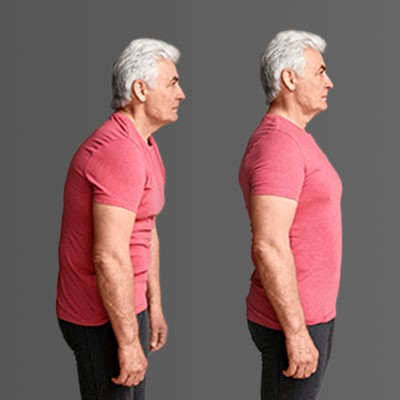 Older man side by side of bad posture and good posture