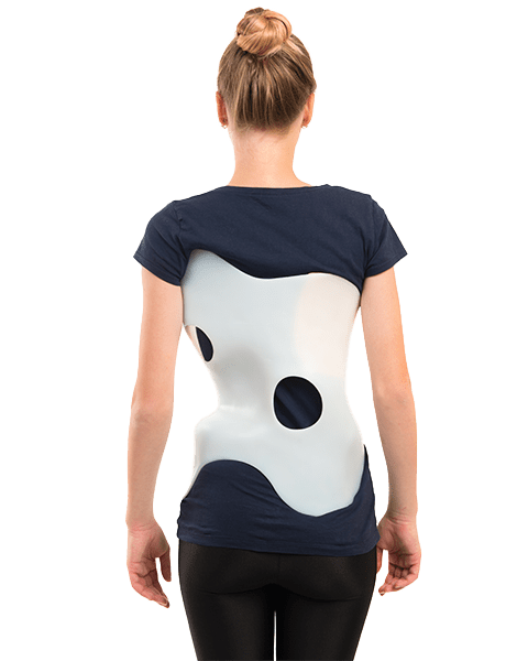 Non-Surgical Scoliosis Brace Treatments