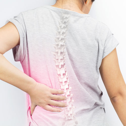 How Can I Manage Mild Scoliosis?